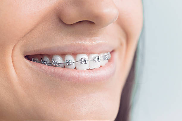 Best Wisdom Tooth Removal  in Aliso Viejo, CA